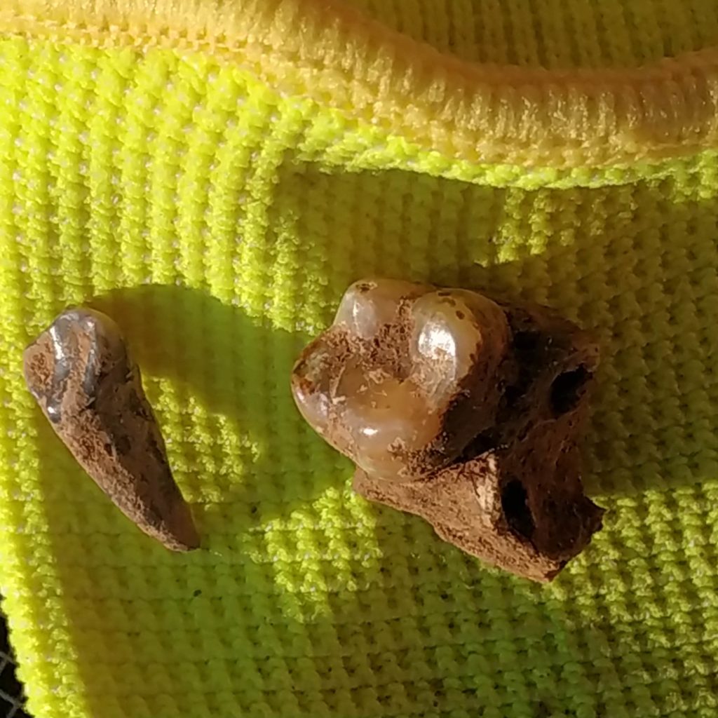 molar humano